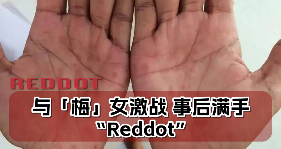 与「梅」女激战 事后满手“Reddot” - 红点网 Red Dot