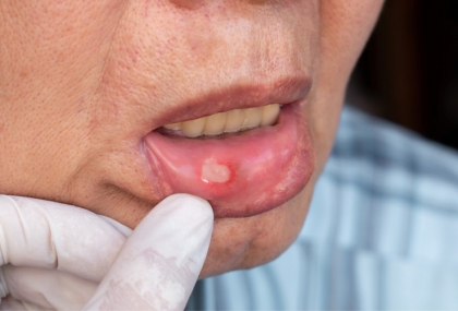 dddb011d-ffde-4133-9517-6571b69ae346