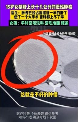 15e5b281e8829de8848fe69c89e5b7a8e5a4a7e681b6e680a7e882bfe798a4-e58cbbe7949fefbc9ae4b88ee9a5aee9a39fe4b9a0e683afe69c89e585b3-2-258x400