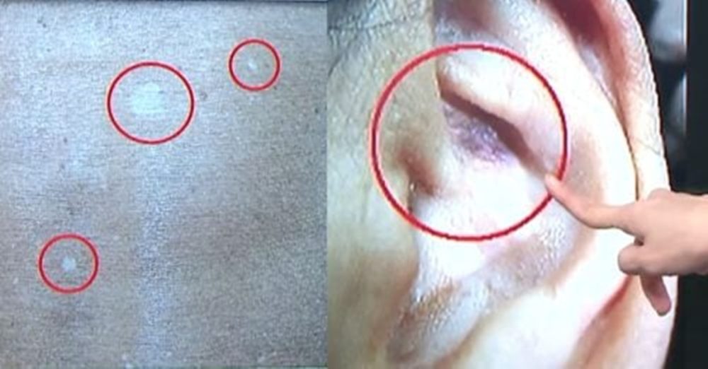 20251107CPYC14a-cancer-500x261