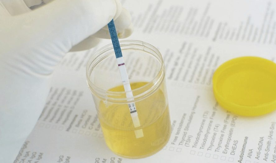 _E5_B0_BF_E6_B6_B2_E6_AA_A2_E6_B8_AC-01