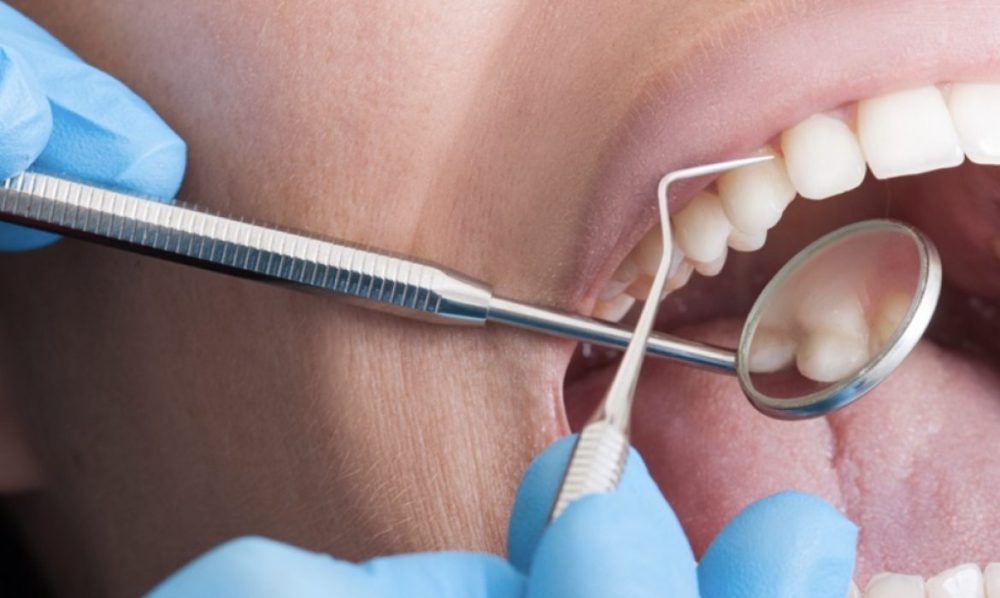 c82cc4e14a1d2c8c8ffff9840d24b558_XL-1170x700