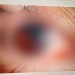 保温杯变定时炸弹?女子开盖被炸破眼球