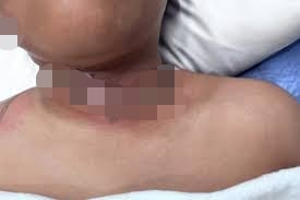 e58585e794b5e7babfe7bca0e9a1b9e993bee8b5b7e781abefbc81-e794b7e7aba5e884b8e5928ce9a288e983a8e783a7e4bca4-1