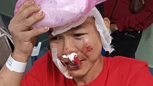 e5b7b4e58da0e5a4a7e8b7afe8bda6e78c9be6929ee691a9e68998e5908ee98083e980b8-e4ba8be4b8bbe591bce59081e79baee587bbe88085e68f90e4be9be8b584-1-aspect-ratio-1600-900