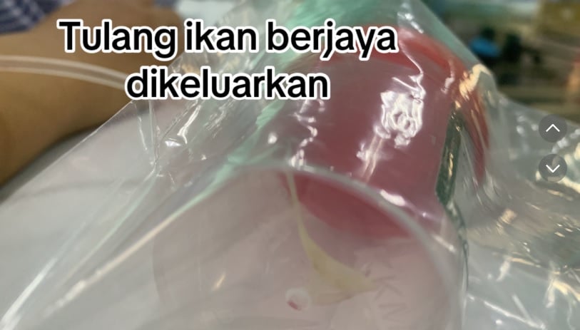 e8a786e9a291e8a2abe9b1bce588bae58da1e59689e4bd8fe999a2e5bc80e58880efbc81-e5a5b3e5ad90e6838ae999a9e58f96e587bae2809ce5b7a8e588bae2809d-2