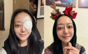 勇敢晒“大小眼”自拍 最后一次手术在即