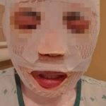 担心女友移情别恋 男子泼滚烫水毁她容