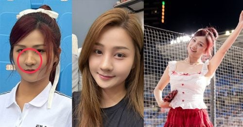 Rakuten-Girls-Nasal-surgery-251216-1.1-500x261