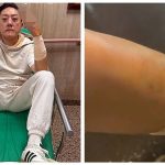 夜店大亨左臂被砍10cm 女伴脸被辣椒水喷惨叫