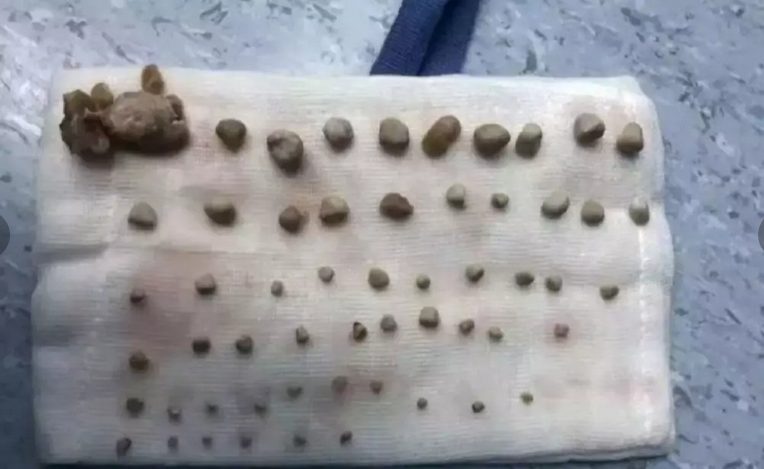 e98391e5b79e9e5b281e7aba5e882bee995bf56e7b292e7bb93e79fb3-e58cbbe7949fe68fade5a688e5a688e6babae788b1e58aa9e585bbe68890e681b6e4b9a0