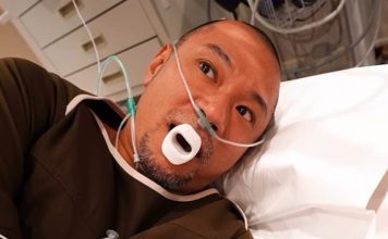 曾志伟前爱将健康亮红灯 元凶竟是每日咖啡