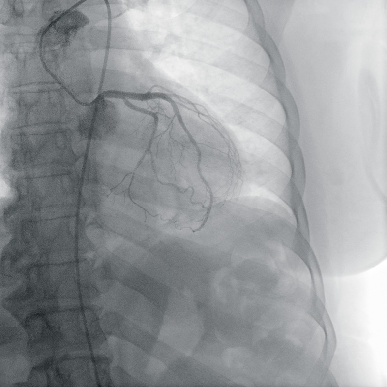 zie-3115-x-ray-00000087_pvdr6_ii_srgb_forscreenonly