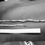 35cm电线插入尿道 少年下体血流不止送医