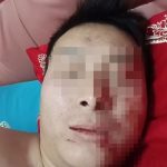 新婚夜遭老婆抓烂脸 男子卖车打官司求离婚