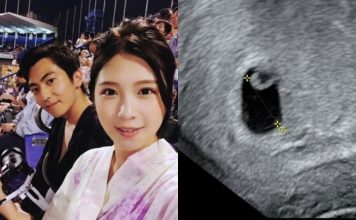 女星九周胎停流产 “出血一整晚”半夜叫喊难眠