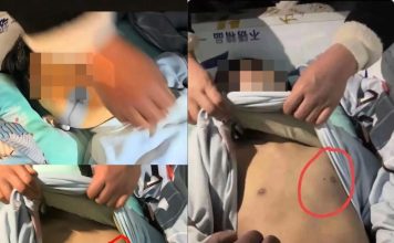 嘴角血迹、胸口针孔 13岁学生离奇身亡惹疑