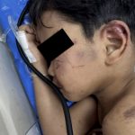 以为断气“弃尸”山林 4岁男童遭阿嬷男友虐重伤