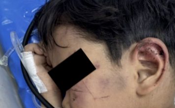 以为断气“弃尸”山林 4岁男童遭阿嬷男友虐重伤