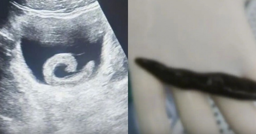 92f7571e19949b513847873b1924f29f