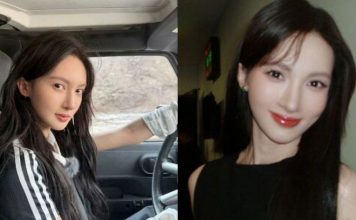 反驳“肇事逃逸找人顶罪”风波 女星晒“满脸血照”还原真相