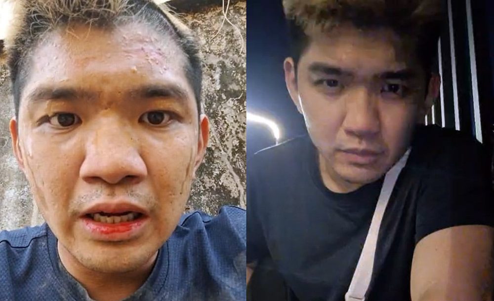 e7bd91e7baa2e2809ce6999ae5ae89e5b08fe9b8a1e2809de981ade69face68b98e79599e68ea7e8afbde8b0a4-e7bd91e6b091efbc9ae2809ce6b4bbe8afa5e2809d