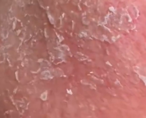 e8bf87e2809ce6b2b9e2809de4b88de58f8aefbc81e38080e4b8ade5a5b3e697a9e6999ae2809ce4bba5e6b2b9e68aa4e882a4e2809de7ab9fe887b4e884b8e884b1