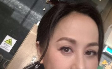 女星甲状腺亢进症状曝光 现身记者会眼歪嘴斜