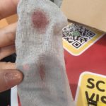 女童游乐场踩图钉染血 家长怒批管理疏失