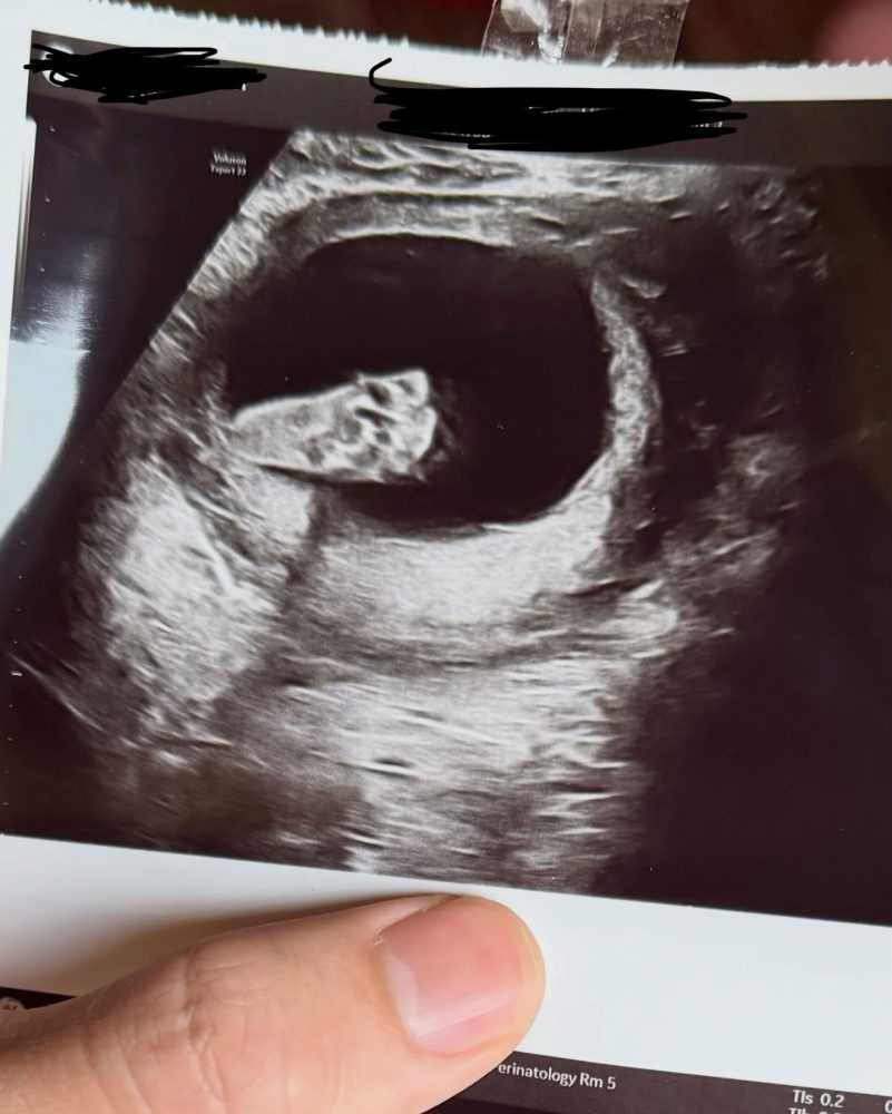 639533839_18361277362201913_8903907038564059213_n