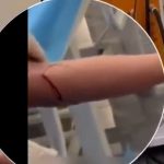 放血排毒排到“血流成河” 黑心诊所血迹斑斑