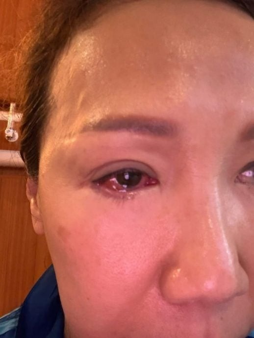 temp_1772017582_e4bdb3e88a82e78783e694bee7839fe88ab1-e68bbfe6b180e79cbce8a2abe7a28ee5b191e781bce4bca4-2_marked1772017583