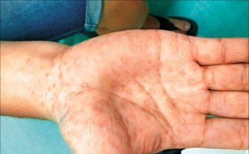 妻子求医查出感染梅毒 丈夫当场情绪崩溃