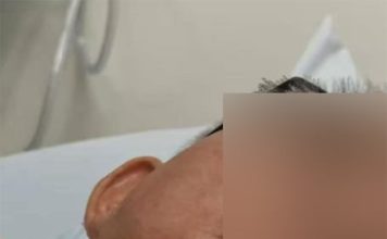 茶室独自用餐遭袭 中年商人突遭割颈