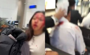 迪拜机场航班一度全停 设施受损多人受伤