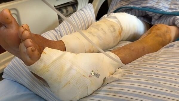 fn260321yao01-090633