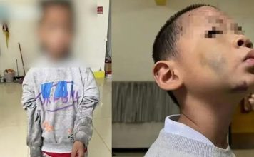 姐弟被逼吃大便、烫下体 父母遭警方逮捕