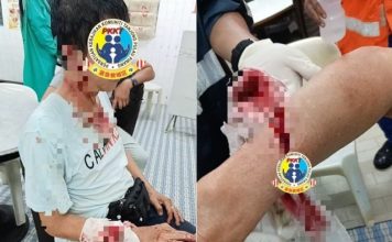 咖啡店惊爆小贩冲突 华裔男子右手受伤