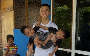 共用部分身体结构长大 连体双胞胎处境让人心酸