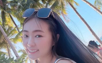 38岁生日见血 女星头部重创惊爆“开洞”