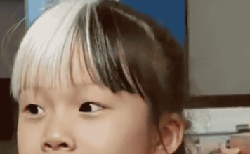 7岁女孩天生白色刘海 全家不敢出门