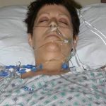 儿时爱穿父亲工地外套 女子长大罹癌仅剩15个月