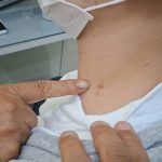 男子遭多人轮流侵犯 颈部还留下多处瘀痕