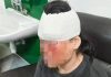 男子因对视遭三人暴打 受害者:不敢反抗怕被杀