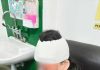 男子因对视遭三人暴打 男子被打到头缝4针