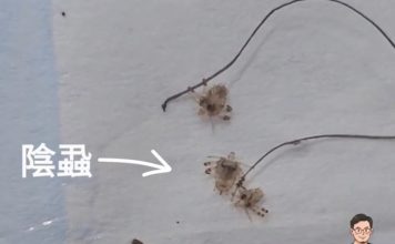 买春后私处痒到崩溃 男子求医抓出“螃蟹虫”
