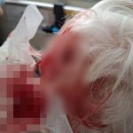 车长未固定轮椅致悲剧 华裔女连人带椅翻倒重摔