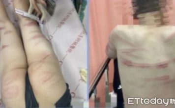 疑电子烟交易谈不拢 少年遭掳囚禁热熔胶虐打