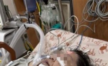 为了要出席女儿毕业礼 女老师减重手术出血身亡