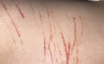 女子采山菜离奇失联身亡 遗体被发现时满身抓痕